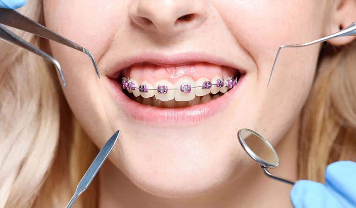 orthodontics