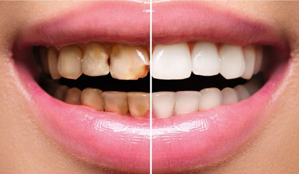 restorative-dentistry